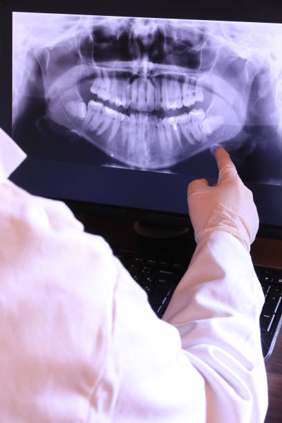 Best Emergency Root Canal Treatment in Solon, IA