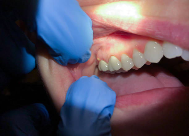 Best Broken or Cracked Tooth Emergency Dentist in Solon, IA